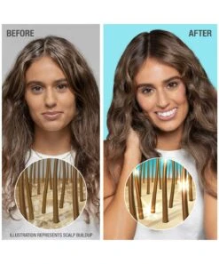 Neutrogena Healthy Scalp Hydro Boost Scalp Scrub With Hyaluronic Acid 11 Neutrogena Healthy Scalp Hydro Boost Scalp Scrub With Hyaluronic Acid -Neutrogena Shop 4067671 carousel4