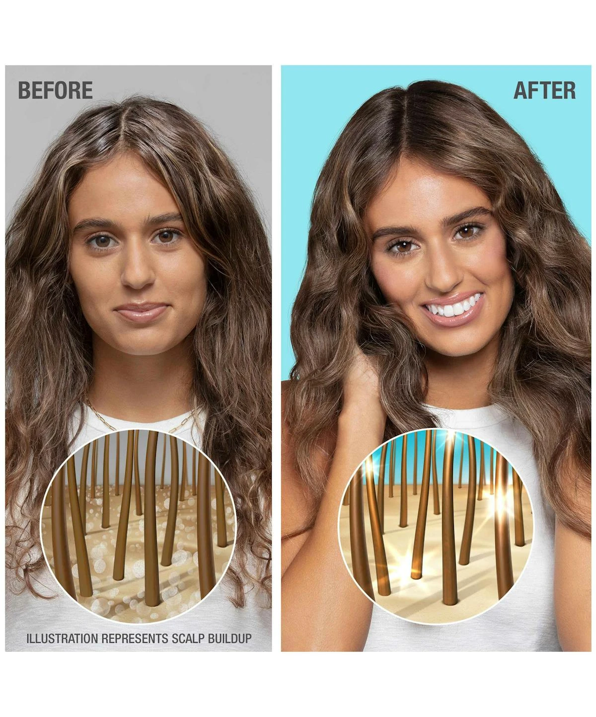 Neutrogena Healthy Scalp Hydro Boost Scalp Scrub With Hyaluronic Acid 6 Neutrogena Healthy Scalp Hydro Boost Scalp Scrub With Hyaluronic Acid - Image 4