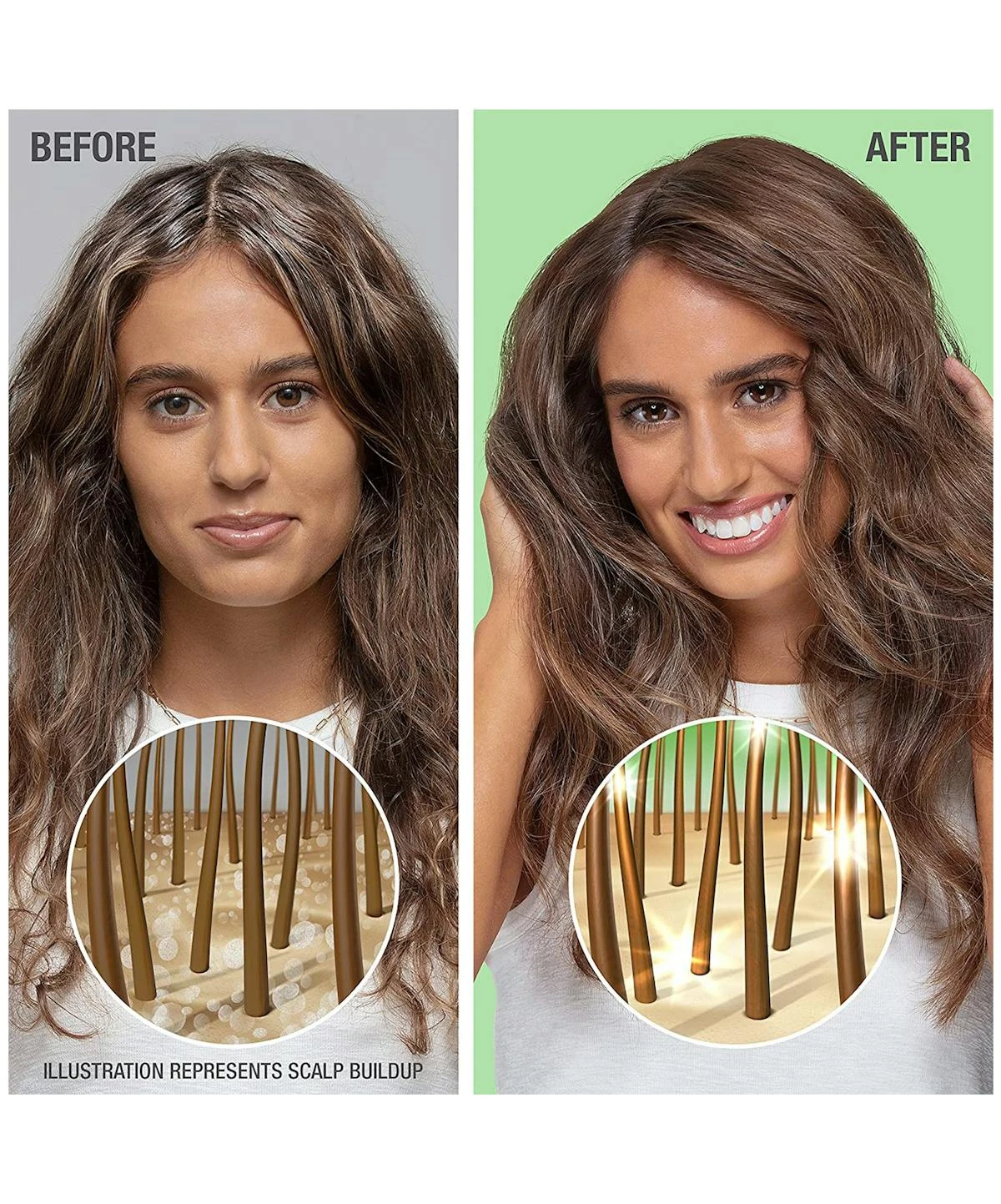 Neutrogena® Healthy Scalp Soothing With Tea Tree Oil Shampoo 6 Neutrogena® Healthy Scalp Soothing With Tea Tree Oil Shampoo - Image 4