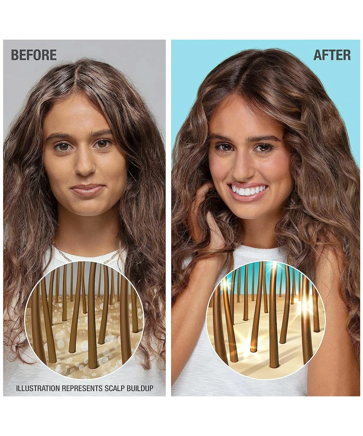 Neutrogena® Healthy Scalp Hydro Boost With Hyaluronic Acid Shampoo 6 Neutrogena® Healthy Scalp Hydro Boost With Hyaluronic Acid Shampoo - Image 4