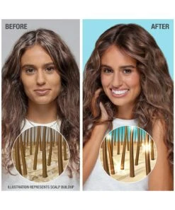 Neutrogena® Healthy Scalp Hydro Boost With Hyaluronic Acid Conditioner 9 Neutrogena® Healthy Scalp Hydro Boost With Hyaluronic Acid Conditioner -Neutrogena Shop 4067806 2023 carousel 4 2