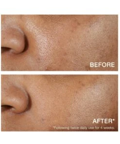 Neutrogena® Hydro Boost Hyaluronic Acid Serum -Neutrogena Shop 6811356 alt 5