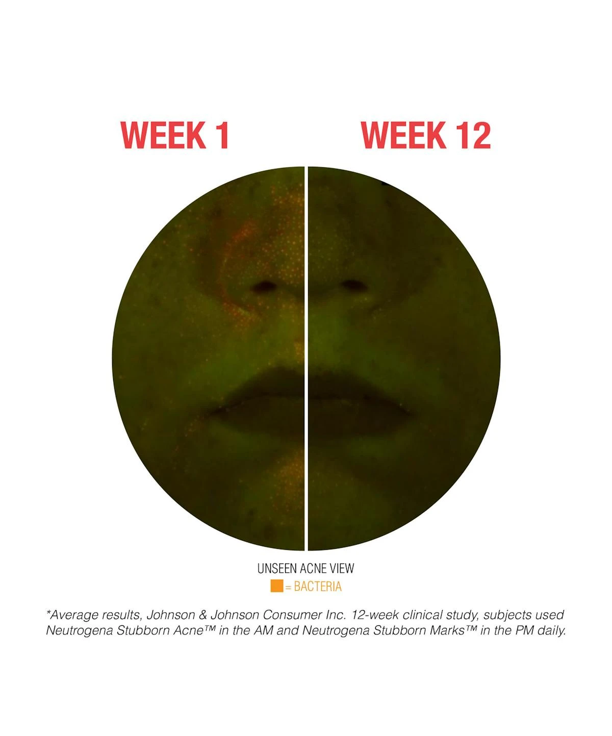 Neutrogena Stubborn Marks PM Treatment 11 Neutrogena Stubborn Marks PM Treatment - Image 9